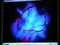 3D Angio-cardiography Live Demo